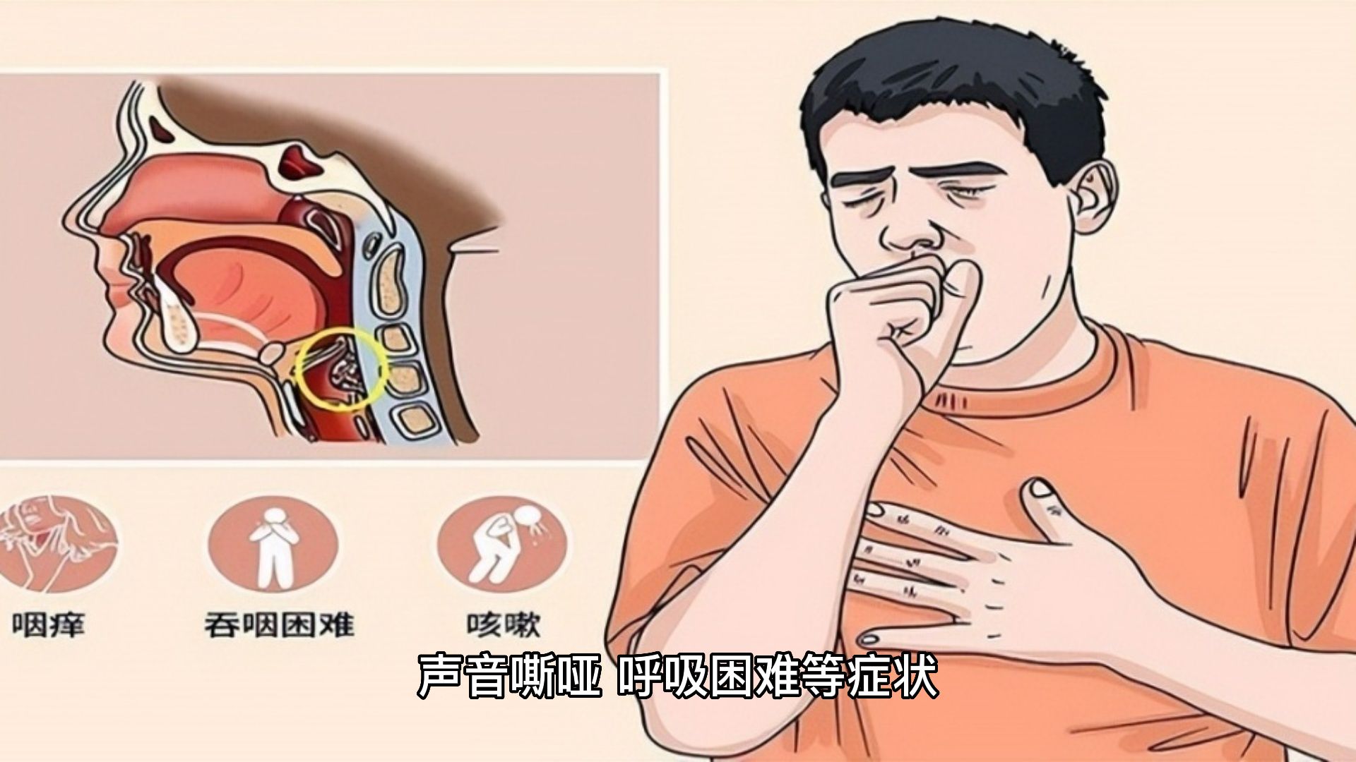 生命_会厌_症状