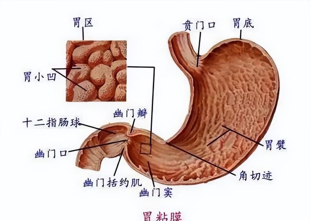 及早诊断减少误诊,梅克尔憩室病理特征是?临床并发症有哪些?