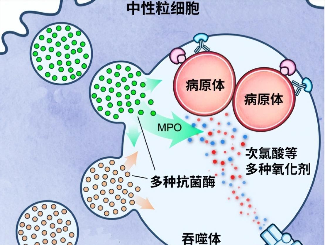 久治难愈的肺结核,中性粒细胞在诊疗过程中有什么变化?