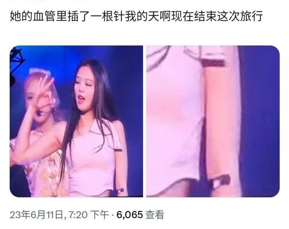 Jennie身体状况 jennie身体有什么病？