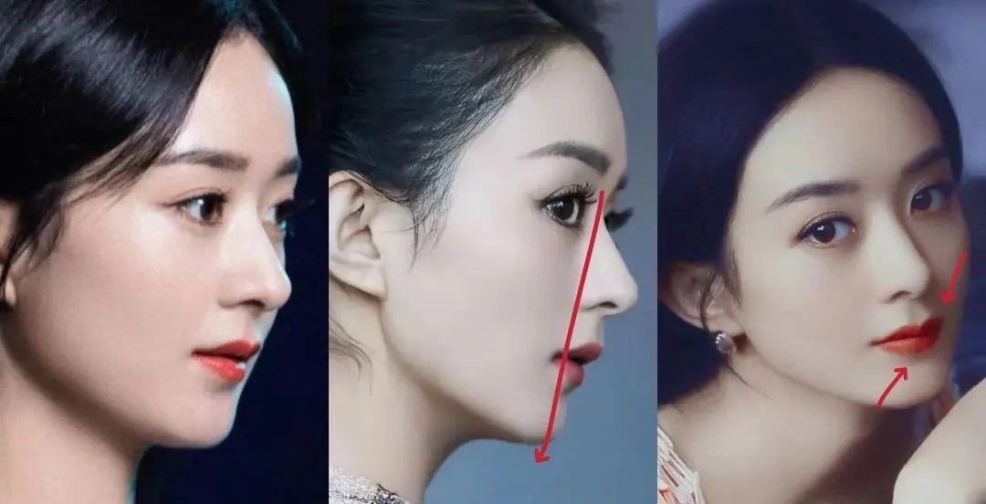 赵丽颖可能算条件最好的,轮廓好,五官大,颌面标准,鼻子条件也数一数二