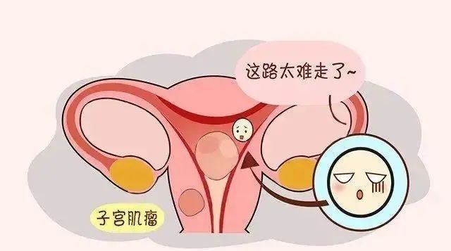 郑州医德佳:如何预防子宫疾病_内膜_女性_经期