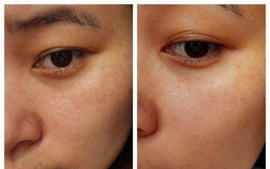 杨颖自带的"滤镜"皮再次惊艳了我,告别美黑后,笑起