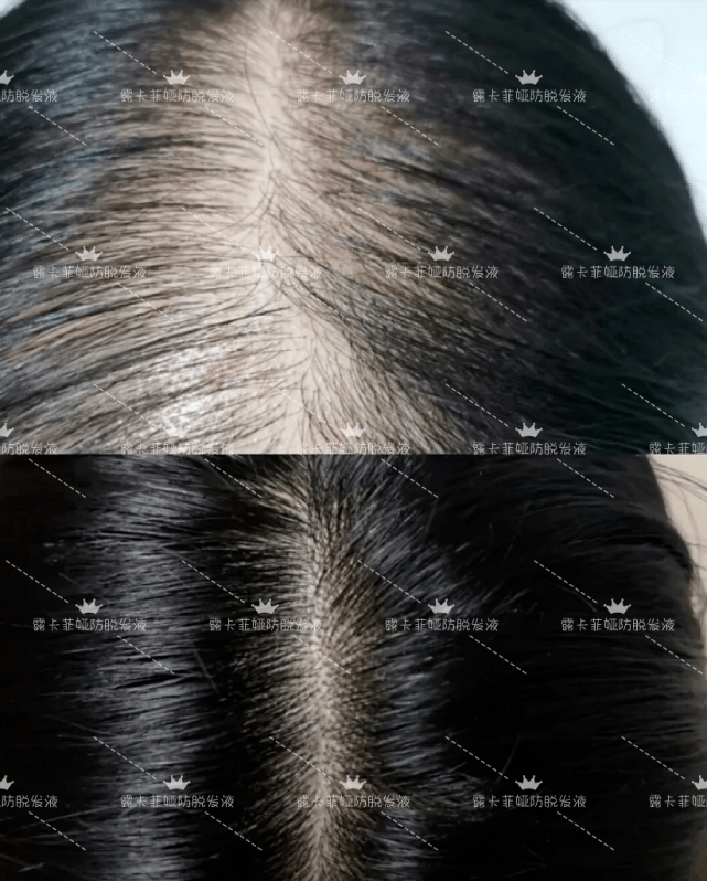 上年纪洗发水防脱生发哪个牌子好？国家认证的放心！（防脱冼发水排名）
