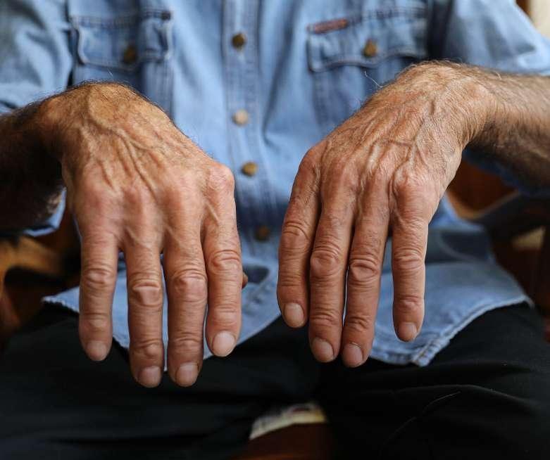 本文将重点探讨中老年人缺钾可能出现的常见症状,以及补钾的合理饮食