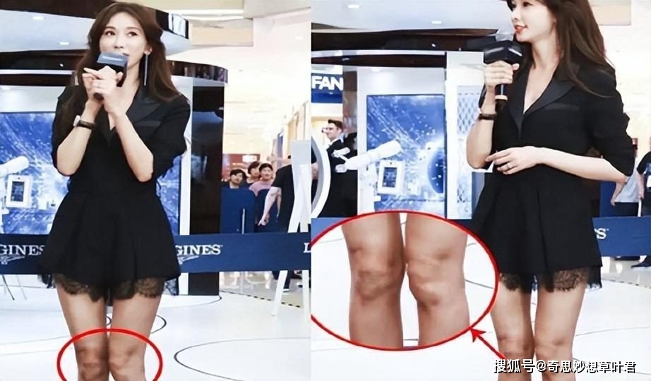 林志玲被家暴到假体掉落,宁愿挨打仍不愿离婚?