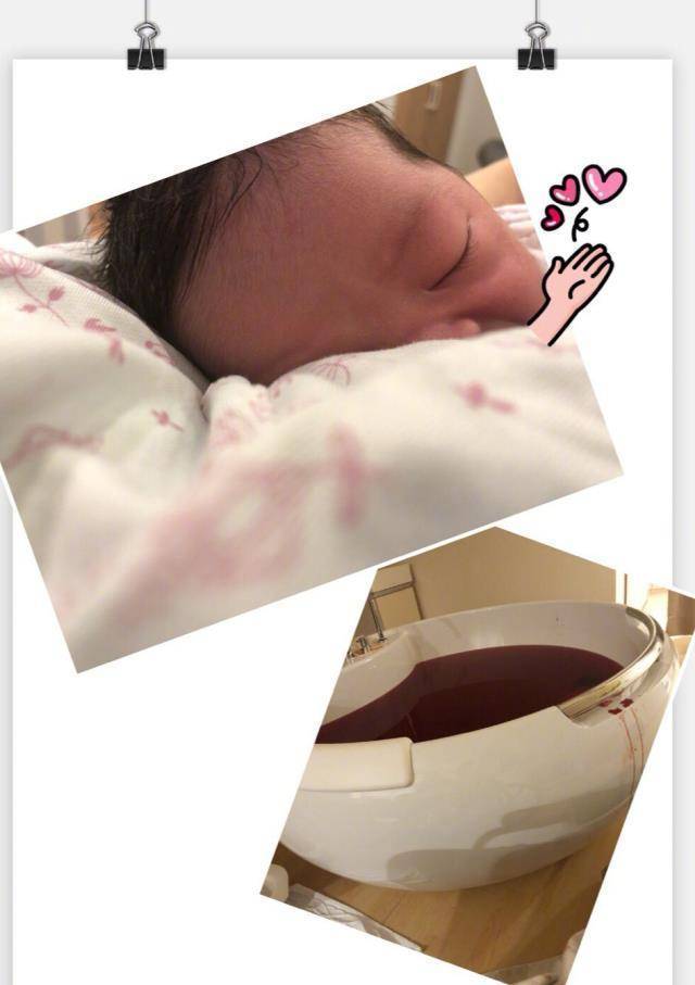 再看看当时满肚子的妊娠纹,谢依霖的肚皮像一个大西瓜,因为怀孕,身材