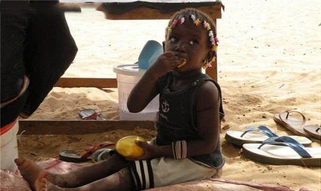 从这张照片中可以看出,这个孩子的皮肤也是非常的黑,但是明显和婴儿