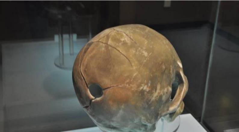 黑龙江古墓出土"胖脸王妃",金丝布包脸,尸检结果令人