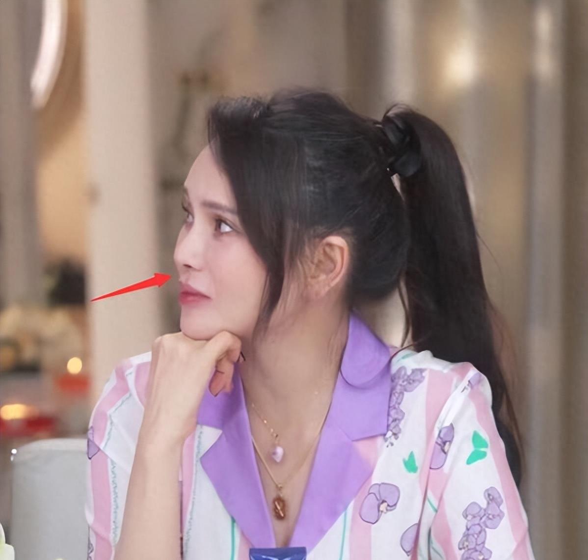 再次受到质疑,嘴巴变得歪歪扭扭,疑似有整容后遗症_视频_穿着_女明星