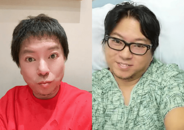 53岁高晓松晒近照暴瘦,网友直呼认不出,疑过度医美撞脸华晨宇_自拍