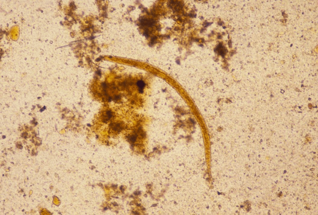 寄生虫病防治知识---蛲虫_传播_儿童_肛门