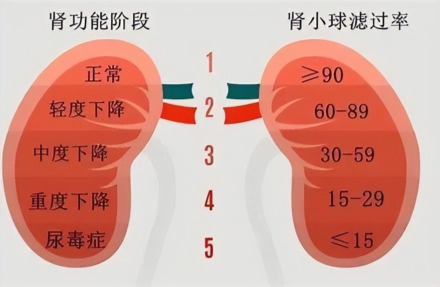 肾功能不全图片标准图片