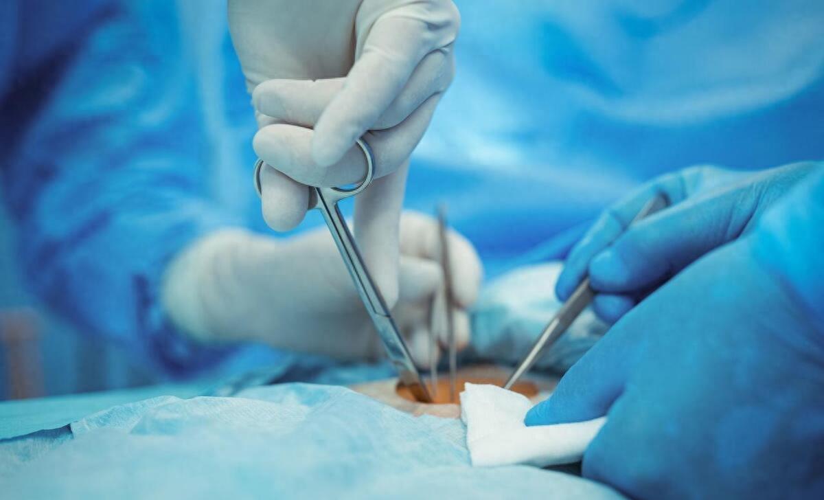 女性的私处做了什么样的整形手术?_身体_进行_区域