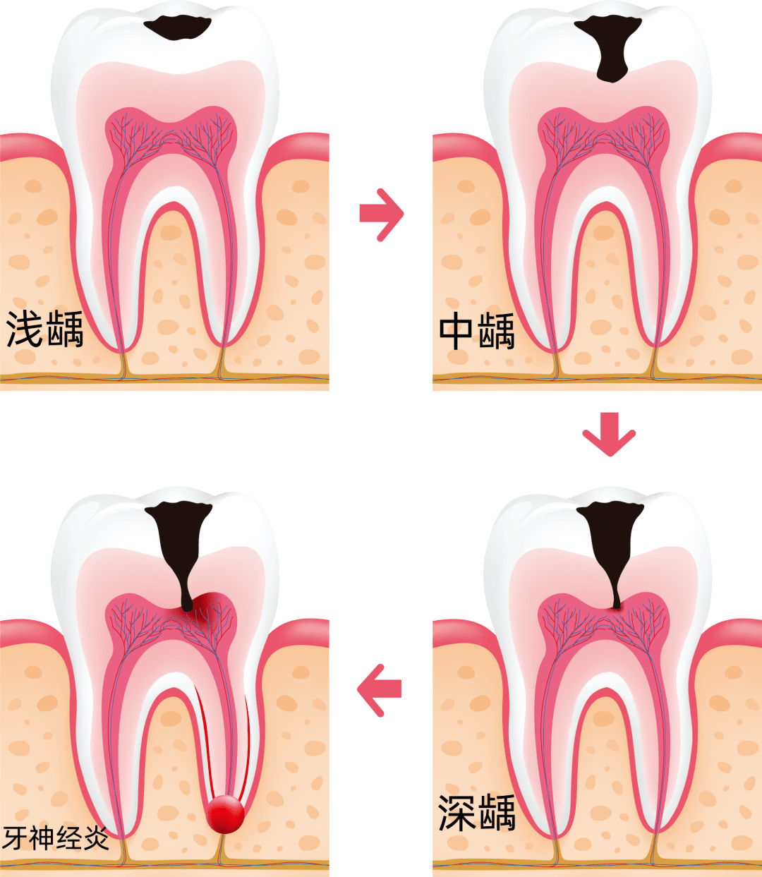 蛀牙的原因卡通图片