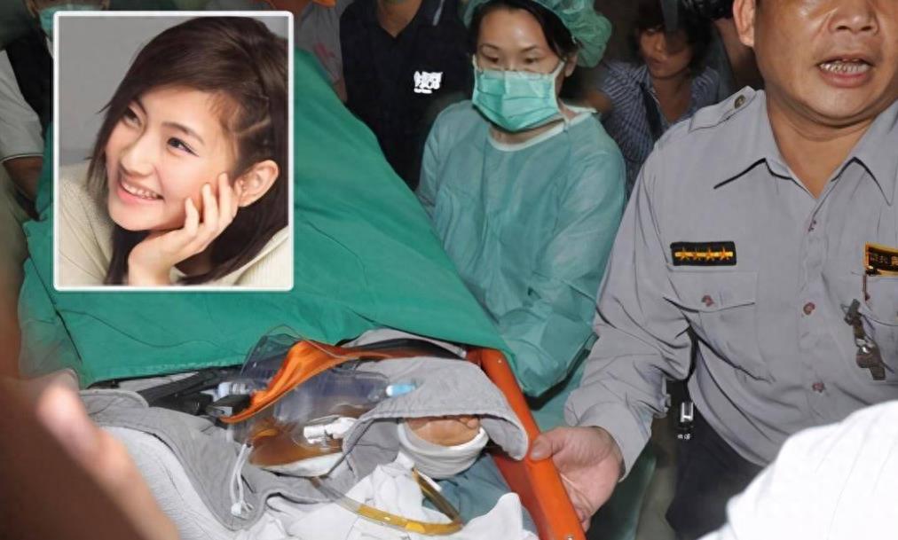 在这场火灾中,俞灏明全身烧伤39%,而selina烧伤面积则高达54%.