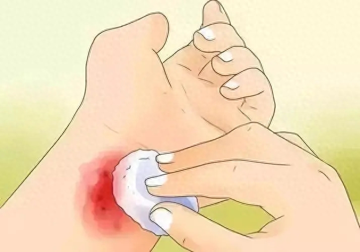 最全秘籍在这里,不希望用到但必须要知道_进行_创口_伤口