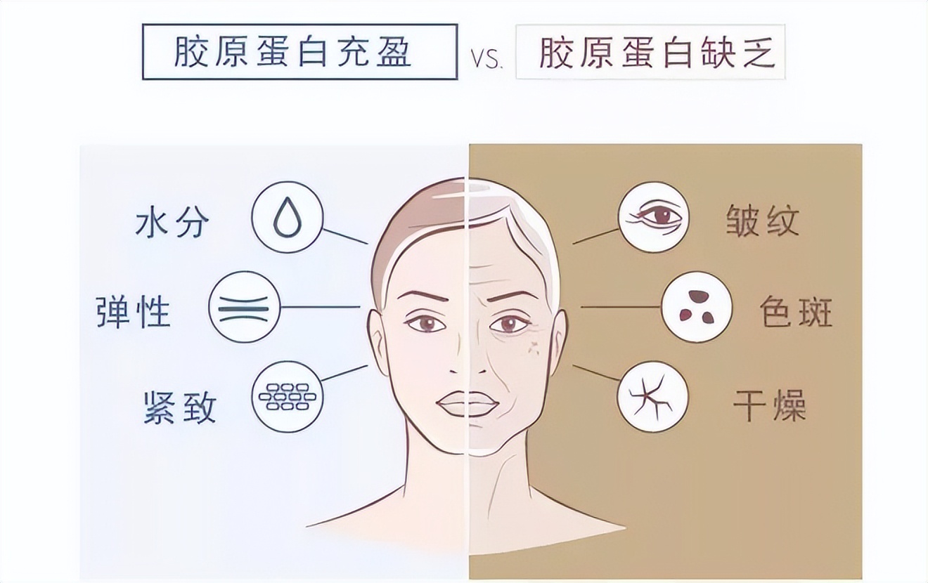 还有人不知道注射胶原蛋白的4种功效吗_皮肤_组织_细胞