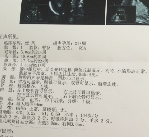 有很多夫妻可能会买来验孕棒或者早孕试纸来检测自己是否怀孕,当检测