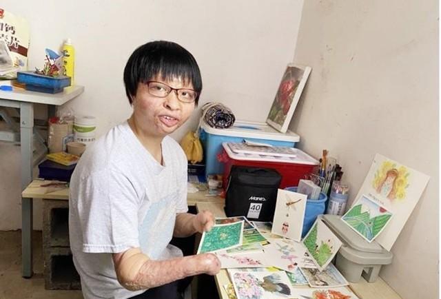 13年前,她为救弟弟烧伤失去双腿双手,13年后588分考上大学_唐敏_唐跃