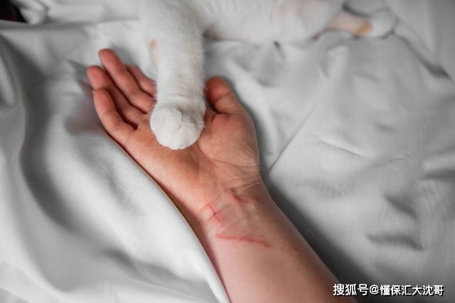 每年4000万人被猫狗咬伤，保险能赔吗？怎么赔？ 