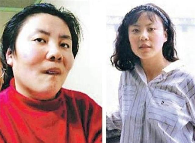 清华高材生朱令:因得罪室友被毒残,今48岁仅有7岁智商_父母_父亲_姐姐