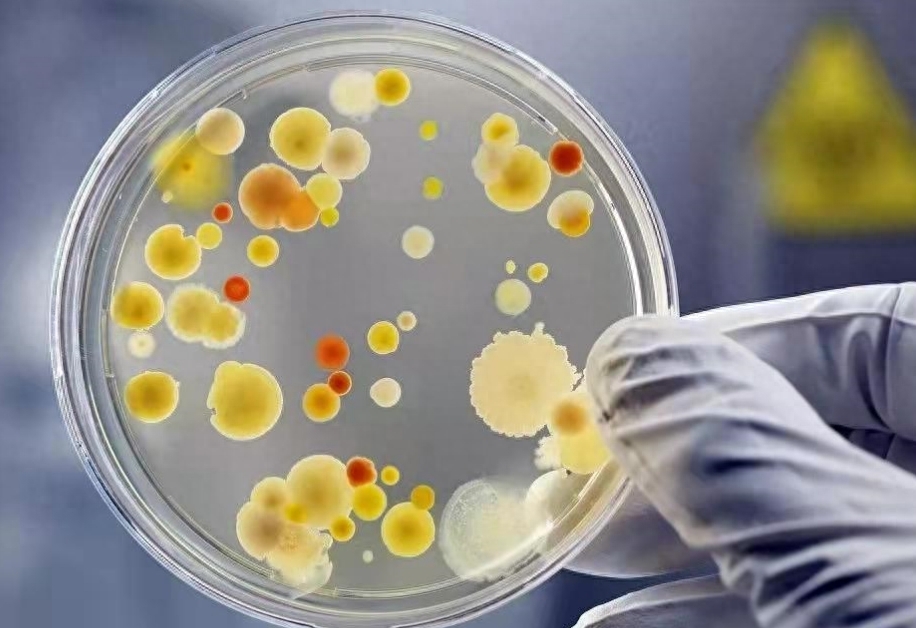 【名院名医】什么情况下要做痰培养?如何做呢?_治疗_细菌_类型