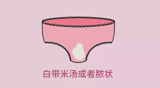 白带出现异常要注意,危害可不是一点半点!_女性_不会影响_情况