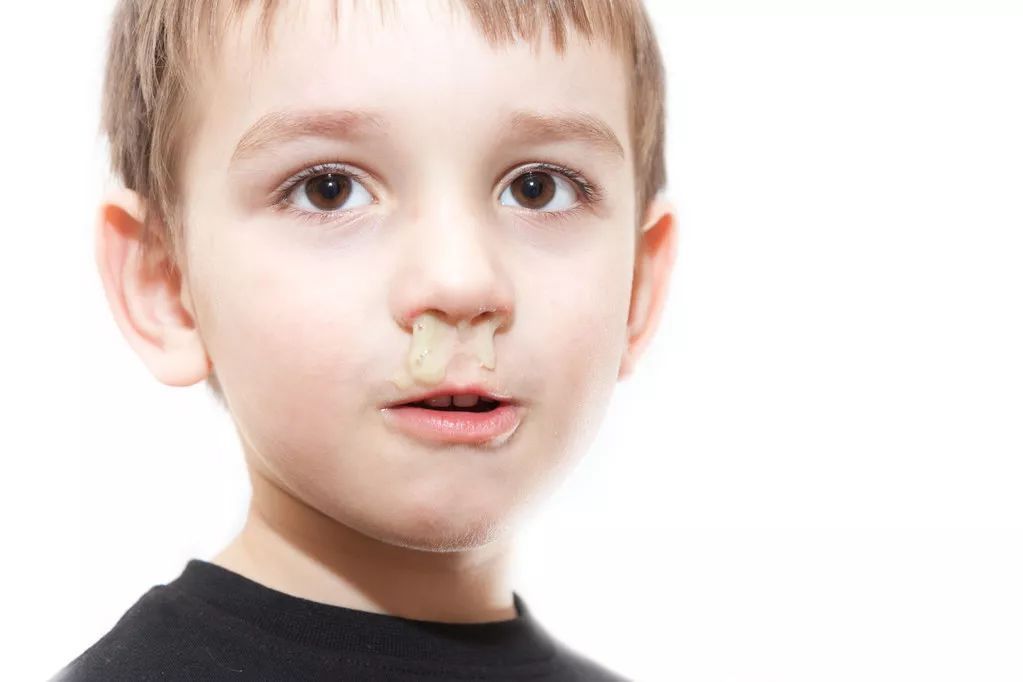 小孩为什么感冒好了还流鼻涕？吃什么药才能好得快？