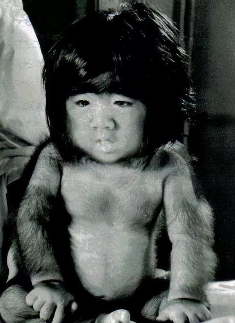 中国第一毛孩:为结婚被逼脱毛,42岁迎娶娇妻,儿子长啥样_于震寰_生活