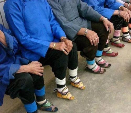 缠足俗称为"裹小脚",是封建社会毒害妇女的一种恶习和铁证,强烈摧残了