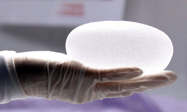 圣嘉新李春财讲解:假体丰胸手术后的注意事项及恢复时间_医生_运动