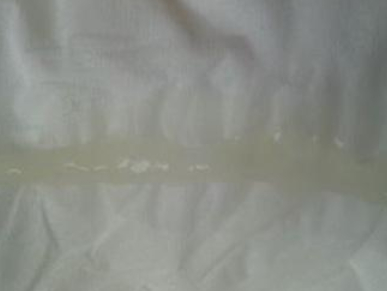 内裤上若是出现这种"现象",可能是"宫颈癌"的前兆,不要大意_身体_女人