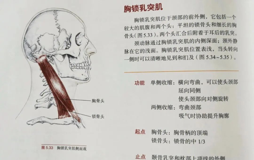 胸锁乳突肌挛缩症状图片