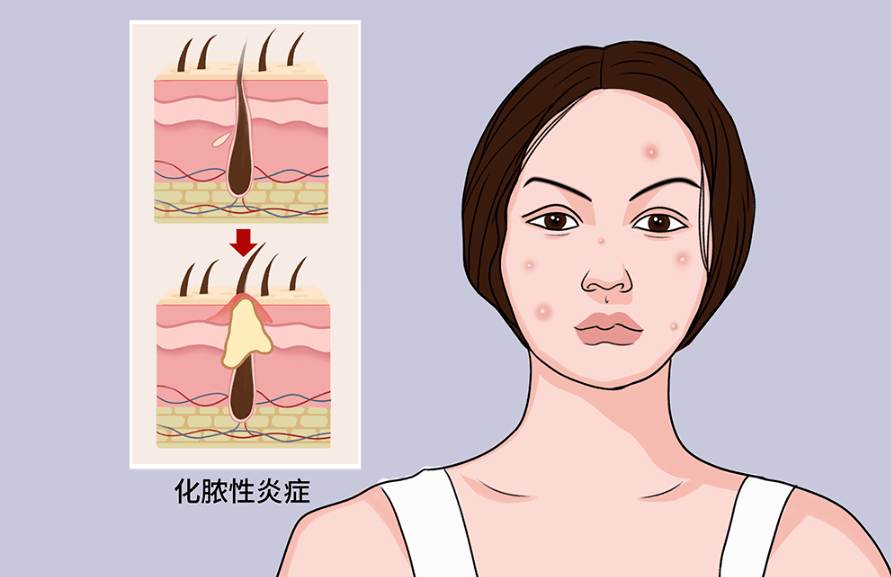 毁容的卡通图片图片