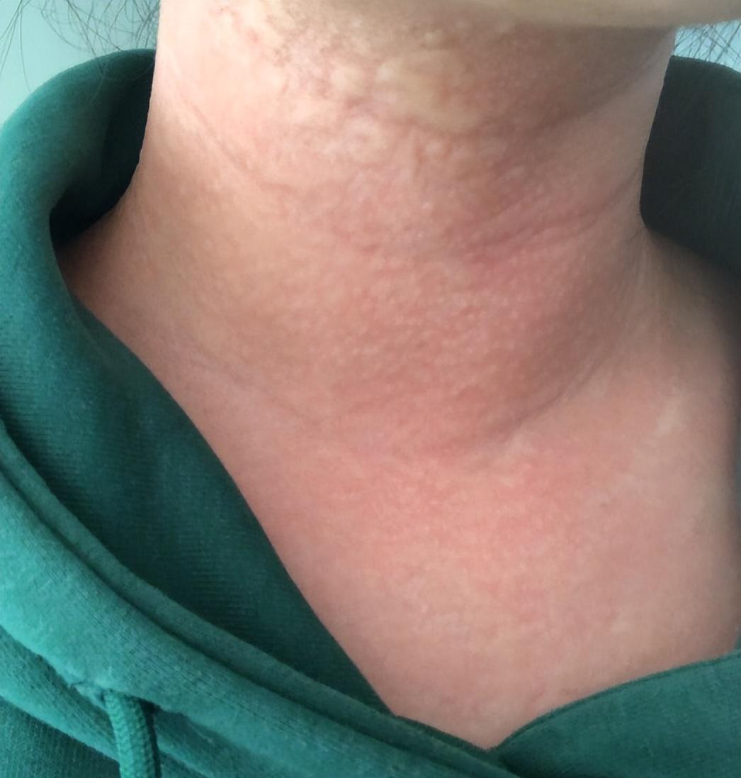 甚至还有因为围巾面料不好皮肤过敏的▼我想大家和猫姐一样都有戴围巾