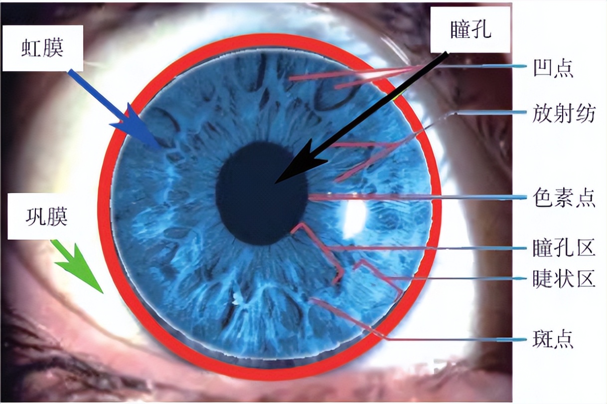 眼睛虹膜边缘发白图片
