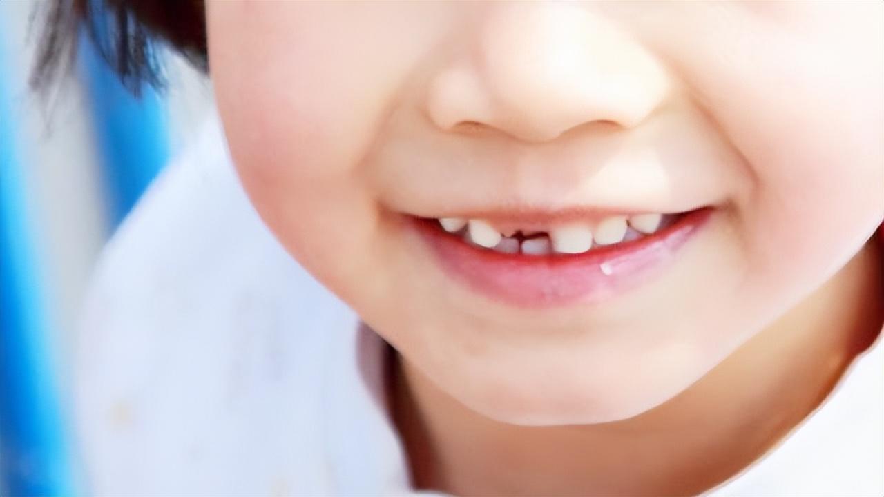 昆明儿牙科普:恒牙迟迟不长出来怎么办?_检查_牙齿_牙龈