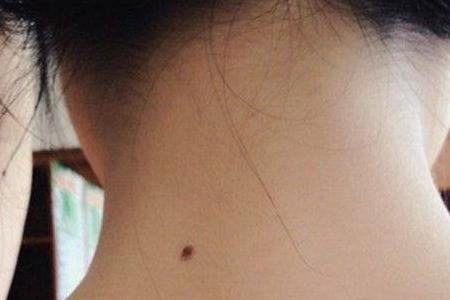 部位_耳朵_女性