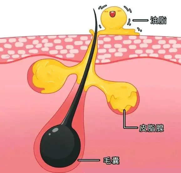 头发出油图片卡通图片