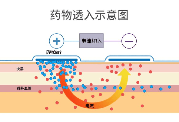 国高医疗超声导药仪