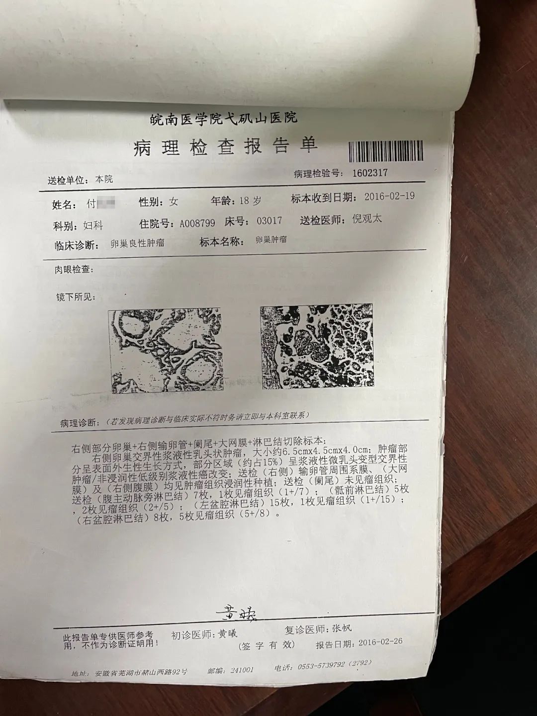 卵巢切除手術,病理診斷:右側卵巢交界性漿液性乳頭狀囊腺瘤,大網膜及