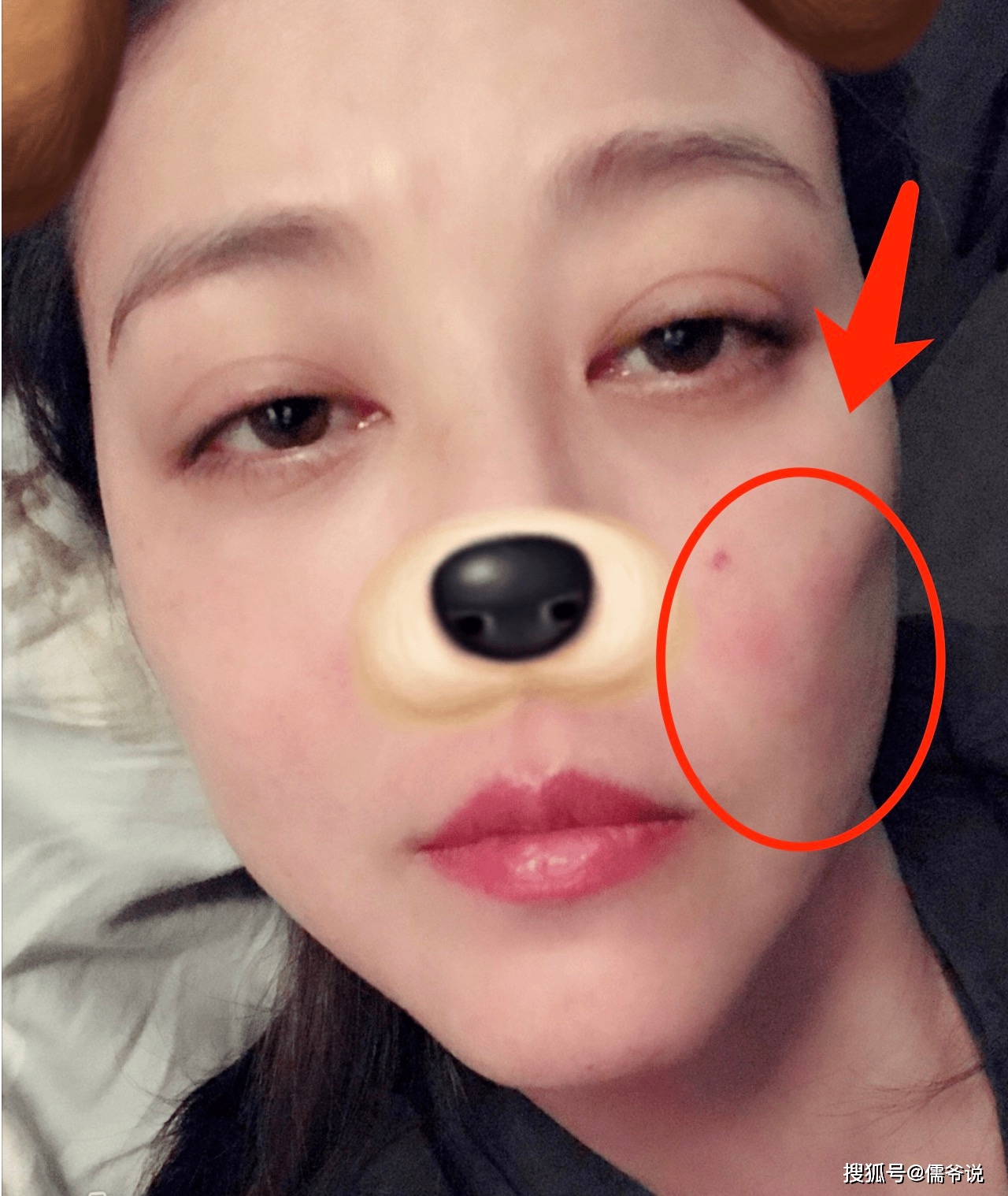 周海媚红斑狼疮病发照曝光!