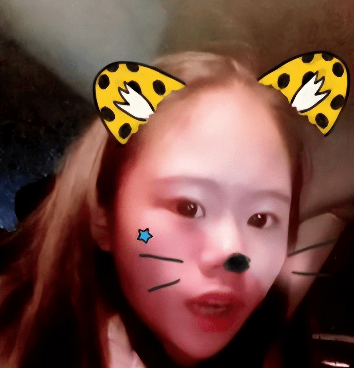 脸削骨_削骨脸会垮吗_削骨脸上会有疤痕吗