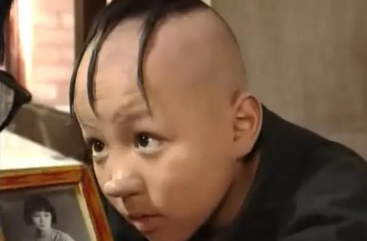 8岁凭"三毛"走红,因化妆师失误变秃,如今的孟智超怎样了?