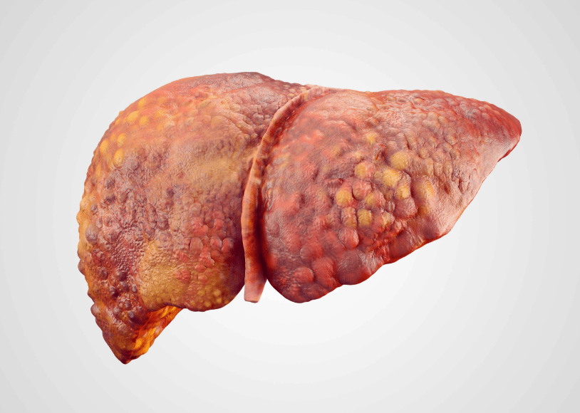 这起悲剧,给所有人敲响警钟_肝脏_肝功能_症状