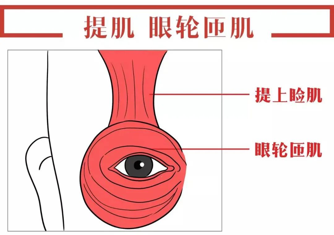 肌肉型腫眼泡由於上眼瞼眼輪匝肌太過發達,造成眼眉厚重,肉也多,捏