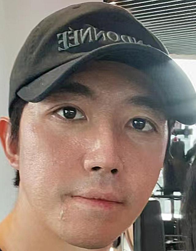 35岁俞灏明健身房被偶遇,十级美颜仍满脸疤痕,需常去医院开药!