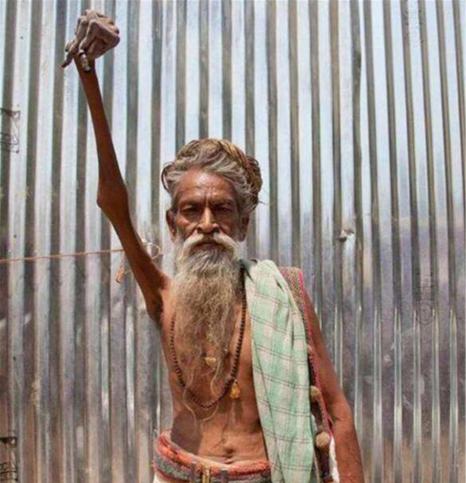 印度最牛苦行僧,为信仰高举右臂47年从不放下,结局咋样?