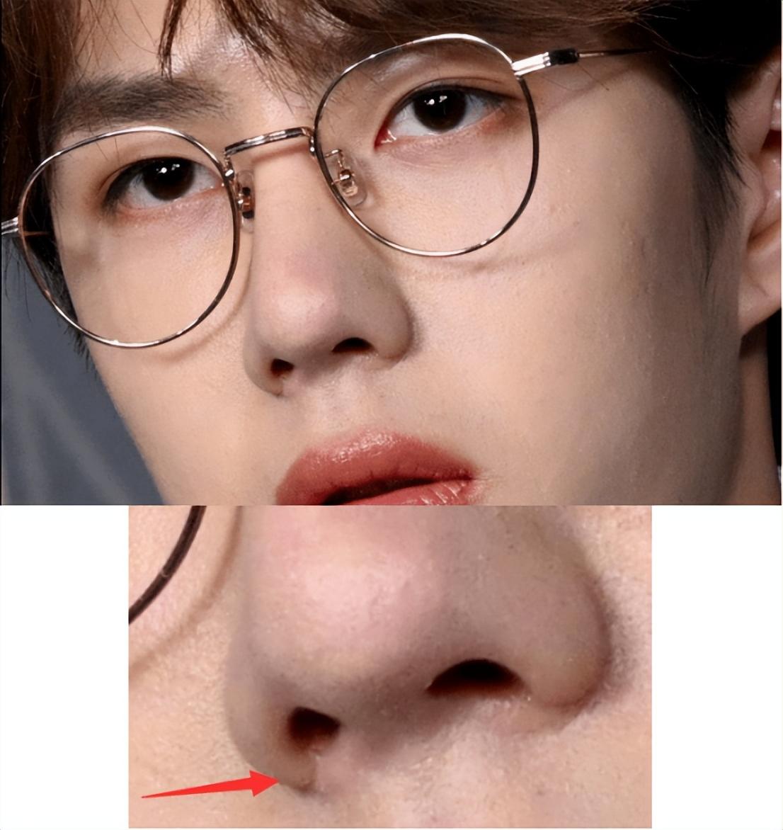 发面馒头脸,透明鼻子,这些人混进央视献礼剧,被天然脸演员碾压_闫妮